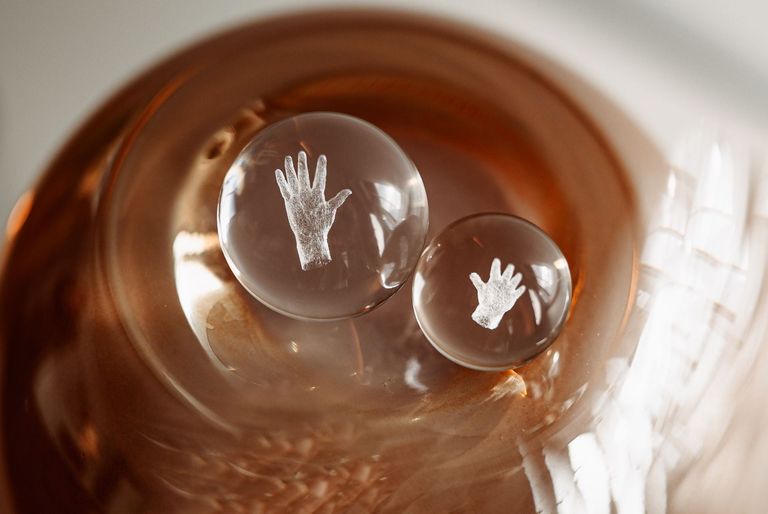 Zwei verschieden große Glasmurmeln, in die jeweils eine Hand eingraviert ist (Symbol für Zwangsstörungen) 